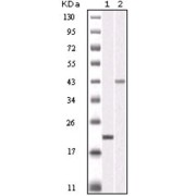 Western blot analysis using AURKB antibody against truncated AURKB recombinant protein (1) and SKN-SH cell lysate (2).