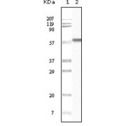 Western blot analysis using CK1 antibody against truncated CK1 recombinant protein.