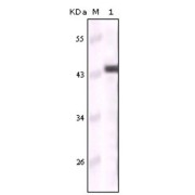 Western blot analysis using CK5 antibody against truncated CK5 recombinant protein.