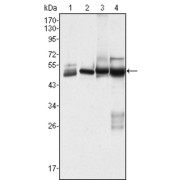 Western blot analysis using CK7 antibody against Hela (1), MCF-7 (2), A431 (3) and A549 (4) cell lysate.