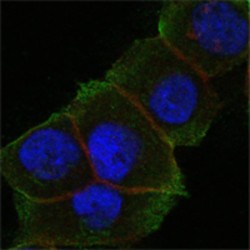 Death Domain Associated Protein / DAP6 (DAXX) Antibody