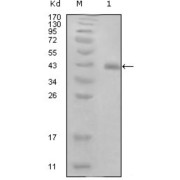 Western blot analysis using E7 antibody against truncated GST-E7 recombinant protein.