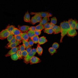 Eukaryotic Translation Initiation Factor 4E (EIF4E) Antibody