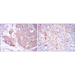 Eukaryotic Translation Initiation Factor 4E (EIF4E) Antibody