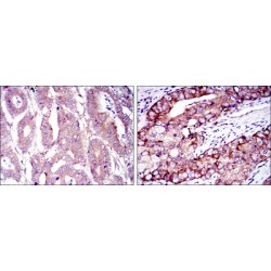 Eukaryotic Translation Initiation Factor 4E (EIF4E) Antibody