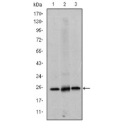 Western blot analysis using EIF4E antibody against Hela (1), HEK293 (2) and K562 (3) cell lysate.