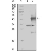 Western blot analysis using EphA4 antibody against truncated Trx-EphA4 recombinant protein (1) and truncated GST-EphA4 (aa777-986) recombinant protein (2).