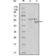 Western blot analysis using EphA6 antibody against truncated MBP-EphA6 recombinant protein (1) and truncated GST-EphA6 (aa695-795) recombinant protein (2).