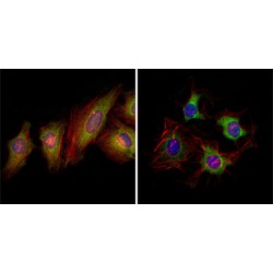 Ephrin Type-B Receptor 2 (EphB2) Antibody