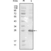 Western blot analysis using EphB3 antibody against truncated EphB3-His recombinant protein.