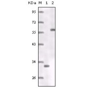 Western blot analysis using ER antibody truncated ER recombinant protein (1) MCF-7 cell lysates (2).