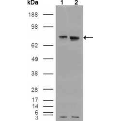 Estrogen Receptor (ESR1) Antibody