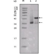 Western blot analysis using ESR1 antibody against truncated ESR1-His recombinant protein (1) and truncated Trx-ESR1 recombinant protein (2).