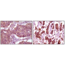 Mitogen-Activated Protein Kinase 1 / ERK2 (MAPK1) Antibody