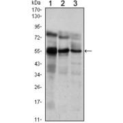 Western blot analysis using ETV5 antibody against Jurkat (1), NIH/3T3 (2) and MCF-7 (3) cell lysate.