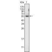 Western blot analysis using ETV4 antibody against K562 cell lysate (1).