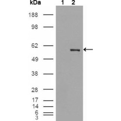 ETS Translocation Variant 4 (ETV4) Antibody