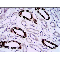 GRB2-Associated-Binding Protein 1 (GAB1) Antibody