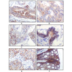 Insulin Like Growth Factor 1 Receptor (IGF1R) Antibody