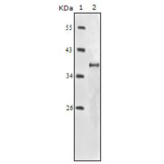 Western blot analysis using IGF1R-Beta antibody against truncated IGF1R-Beta recombinant protein.