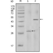 Western blot analysis using IL2 antibody against full-length IL2 recombinant protein with Trx tag (1) and full-length IL2-hIgGFc transfected HEK293 cell lysate (2).