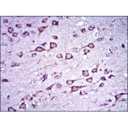 Doublecortin (DCX) Antibody