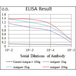 Integrin-Linked Protein Kinase (ILK) Antibody