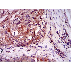 Integrin-Linked Protein Kinase (ILK) Antibody