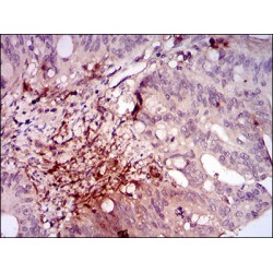 Integrin-Linked Protein Kinase (ILK) Antibody