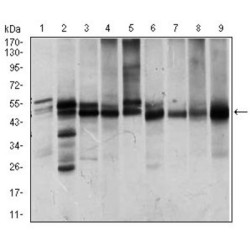 Integrin-Linked Protein Kinase (ILK) Antibody