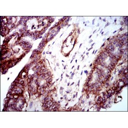 Integrin Beta 1 (ITGB1) Antibody