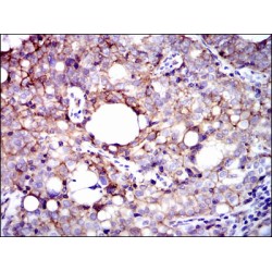 Integrin Beta 1 (ITGB1) Antibody