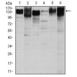 Integrin Beta 1 (ITGB1) Antibody