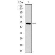 Western blot analysis using ITGB1 antibody against human ITGB1 (AA: 50-270) recombinant protein. (Expected MW is 50.6 kDa).