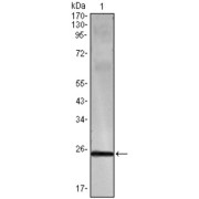 Western blot analysis using IFN gamma antibody against truncated IFN-gamma recombinant protein.