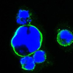 Insulin Gene Enhancer Protein ISL-1 (ISL1) Antibody