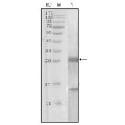 Western blot analysis using KLK3 antibody against truncated KLK3 recombinant protein.