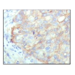 Lysyl-tRNA Synthetase (KARS) Antibody