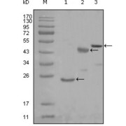 Western blot analysis using KARS antibody against truncated Trx-KARS recombinant protein (1), truncated MBP-KARS (aa90-174) and full length KARS (aa1-188) transfected CHO-K1 cell lysate (3).