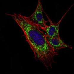 Kelch-Like Protein 11 (KLHL11) Antibody