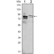 Western blot analysis using KLHL11 antibody against Hela (1) and MCF-7 (2) cell lysate.