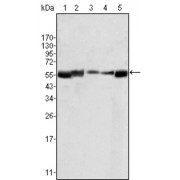 Western blot analysis using LYN antibody agains HL60 (1), L540 (2), SLLP-M2 (3), SEM (4) and Ramos (5) cell lysate.
