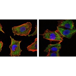 CREB Regulated Transcription Coactivator 1 (CRTC1) Antibody