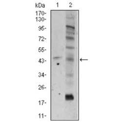 Frizzled Homolog 5 (FZD5) Antibody