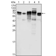 Western blot analysis using Metadherin antibody against K562 (1), SKBR-3 (2), T47D (3), Hela (4) and MCF-7 (5) cell lysate.