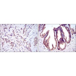 Apoptosis Signal Regulating Kinase 1 (MAP3K5) Antibody