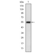 Western blot analysis using MAP3K5 antibody against human MAP3K5 (AA: 922-1108) recombinant protein. (Expected MW is 46.5 kDa).