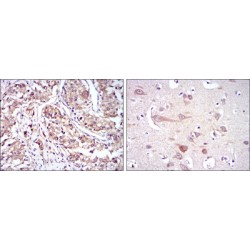 Heat Shock Protein 90kDa Alpha B1 (HSP90AB1) Antibody