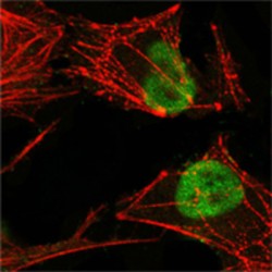 DNA Mismatch Repair Protein Msh2 (MSH2) Antibody