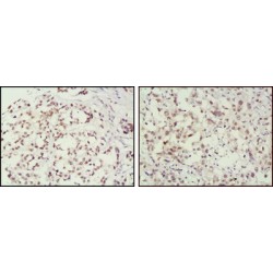 DNA Mismatch Repair Protein Msh2 (MSH2) Antibody